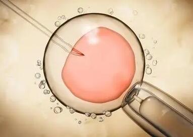 质量弱影响男性的育试管受孕成为了解决问题的有效方法